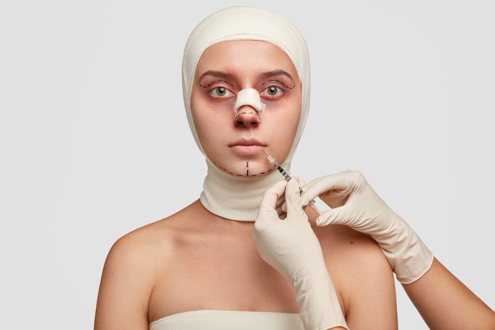Bone Augmentation with Chin Implant