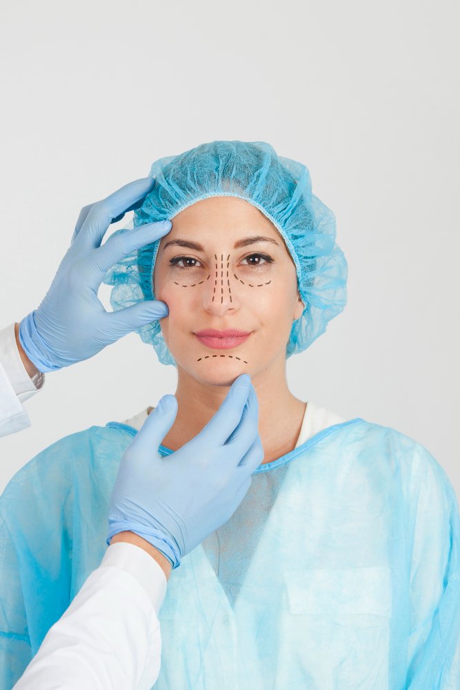 Z-Epicanthoplasty