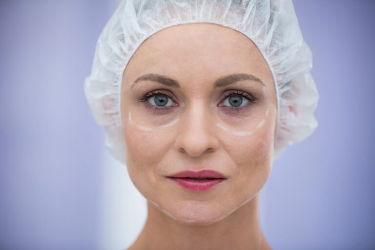 Blepharoplasty