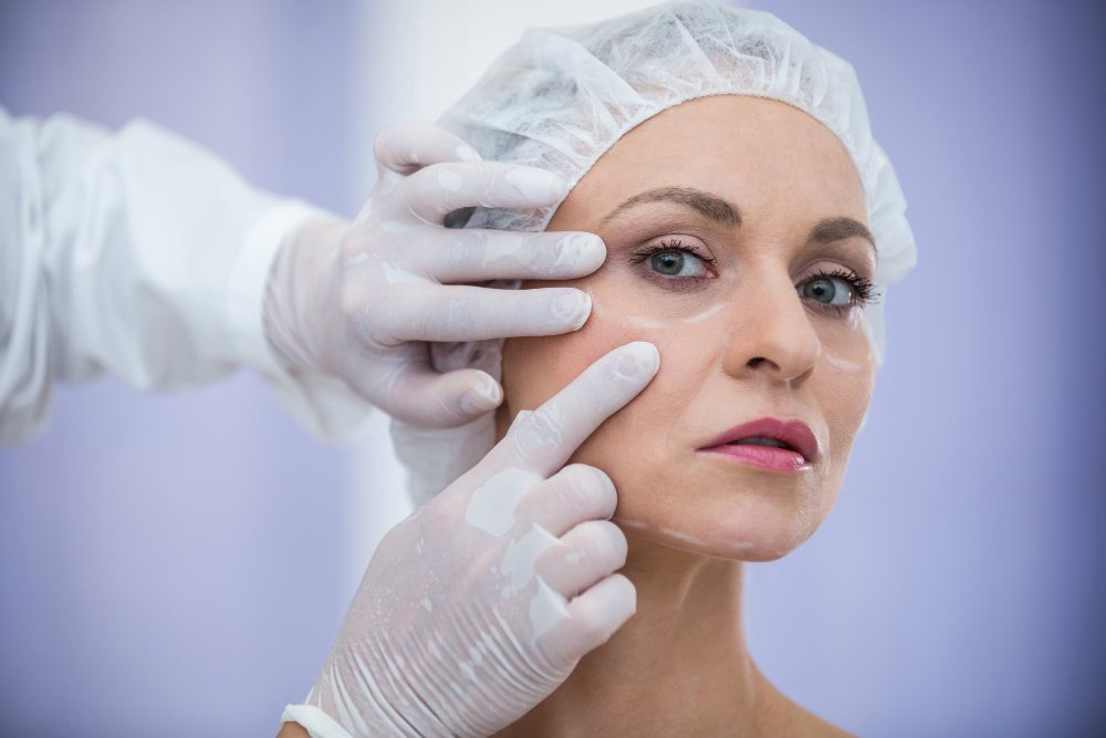 Permanent Double Eyelid Surgery