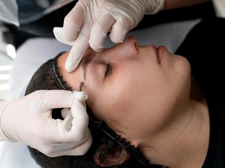 Open Brow Lift Surgery