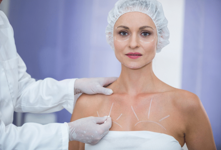 Capsulectomy Revision