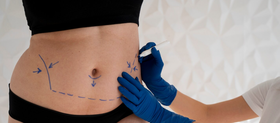 Hip Line Contouring