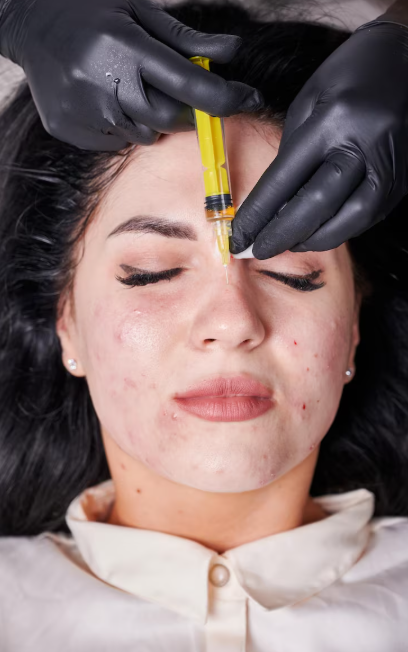 Aqua PRP Rejuvenation