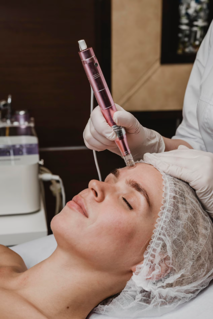 Flawless Exosome Lift