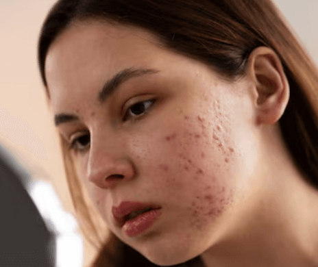 Brown Spot Dual Toning