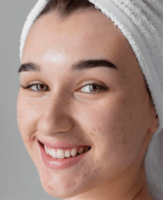 Advanced Chin Projection Fillers