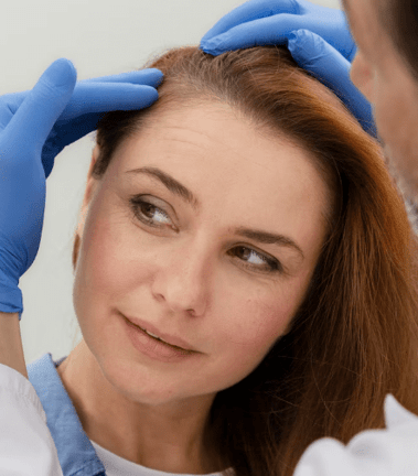 Androgenic Hair Loss Exosome Therapy