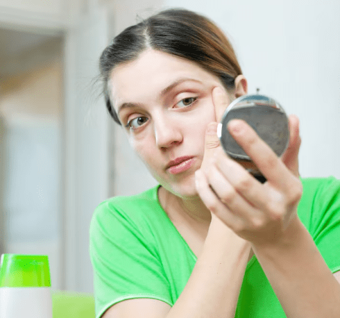 Anti-Bacterial Acne Facial