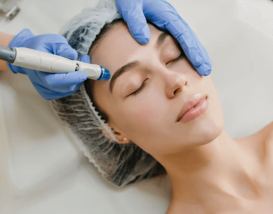 Aqua Peel Facial