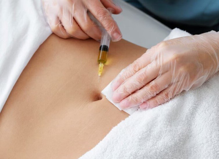 Lipodissolve Injection