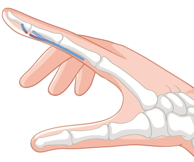 Calcium-Based Hand Contouring
