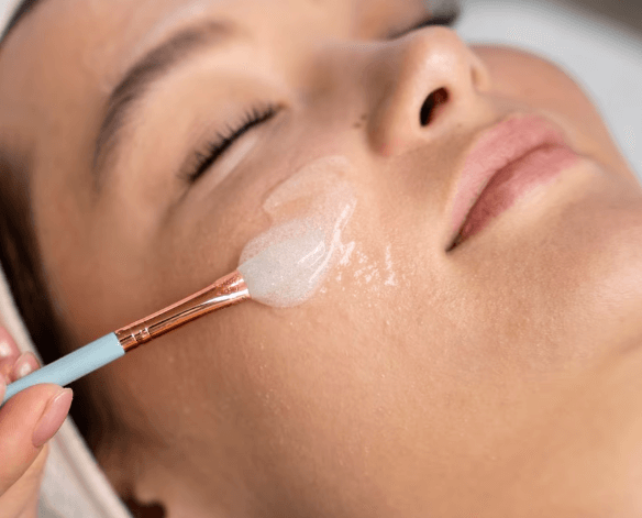 Chemical Peels