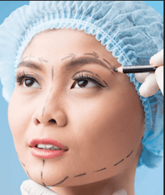 Chin Augmentation with HA Fillers