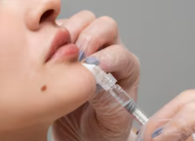 Symmetry Correction Chin Fillers
