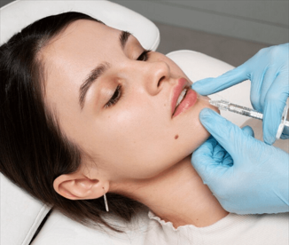 Chin-to-Jaw Harmonizing Fillers