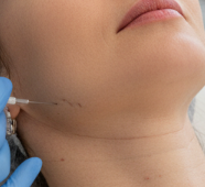 Collagen-Boost Neck Filler