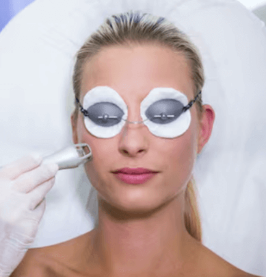 Collagen Remodeling CO2 Laser