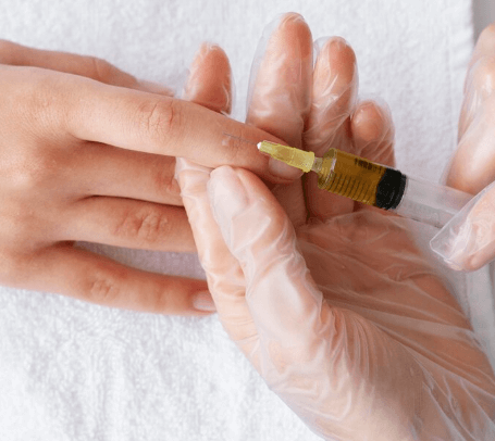 Collagen-Stimulating Hand Fillers