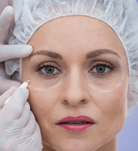 Dark Circle Correction Fillers