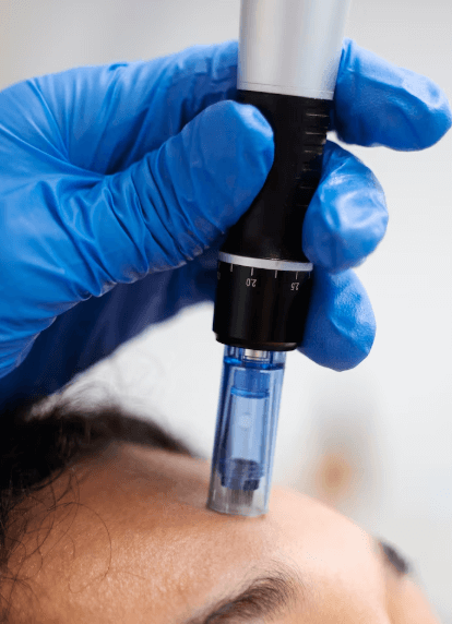 Elasticity Boost Microneedling Facial