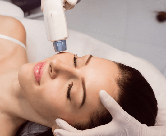 Valentine Laser Protocol