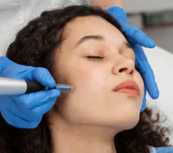 Venus Legacy Jawline Contouring