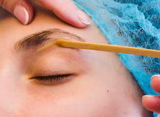 Express Mini-Shunt Implantation