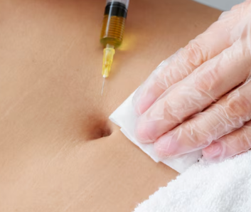 Flanks Fat Dissolving Injections