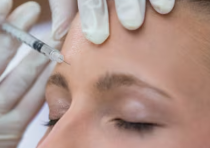 Forehead Contouring