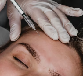 Elegant Forehead Lift with HA Fillers