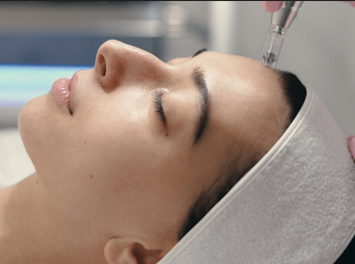 Full Face Oligio RF Lift