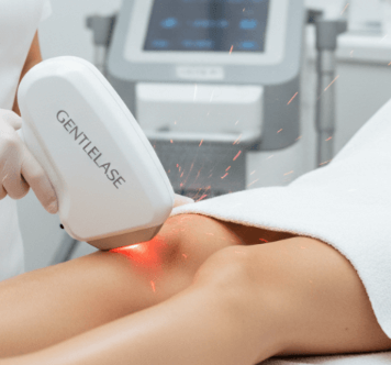 GentleLase Laser