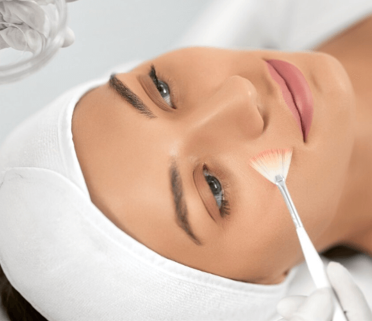 Luminous Skin Chemical Peel