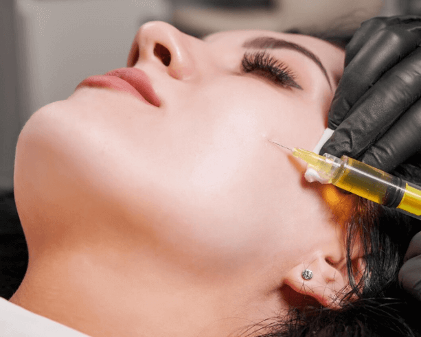 Gold RF Microneedling Facial