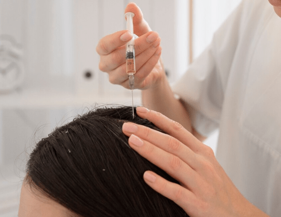 Hair Density PRP Therapy in Korea