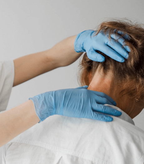 Hair Loss Prevention Exosome Therapy