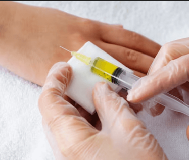 Hand Contour Refinement Fillers