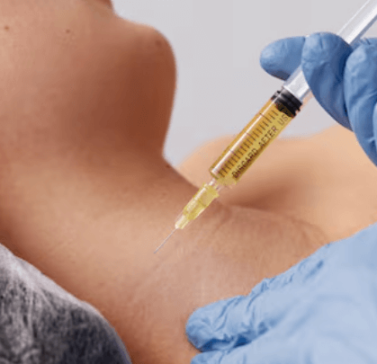 Hyaluronic Acid Neck Filler