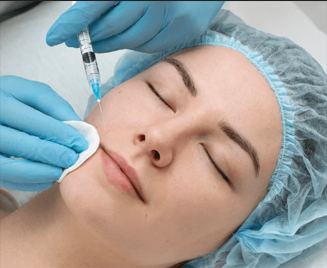 Hyaluronic Acid Tear Trough Fillers