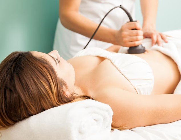 Intracel RF Microneedling