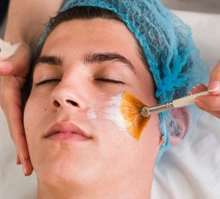 Kojic Acid Peel