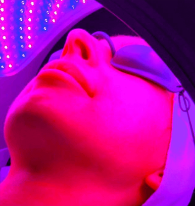LED Acne Therapy Facial