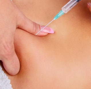 Lower Abdomen Fat Dissolving Injections