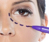 Lower Eyelid Filler Enhancement