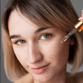 Melasma Corrector with Arbutin