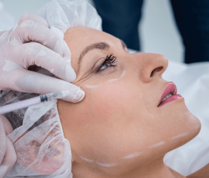 Mesotherapy PRP Facial