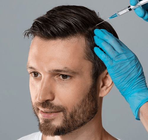 Mesotherapy PRP Hair Restoration