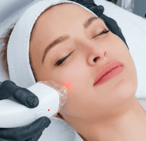 Midface Oligio RF Lift