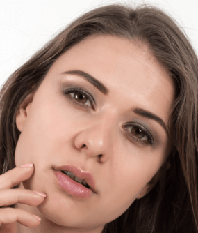Natural Nose Lift with HA Fillers